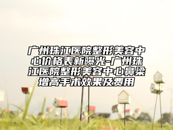 广州珠江医院整形美容中心价格表新曝光-广州珠江医院整形美容中心鼻梁增高手术效果及费用