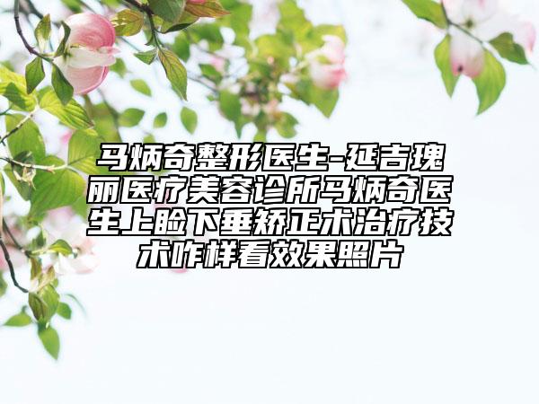 马炳奇整形医生-延吉瑰丽医疗美容诊所马炳奇医生上睑下垂矫正术治疗技术咋样看效果照片