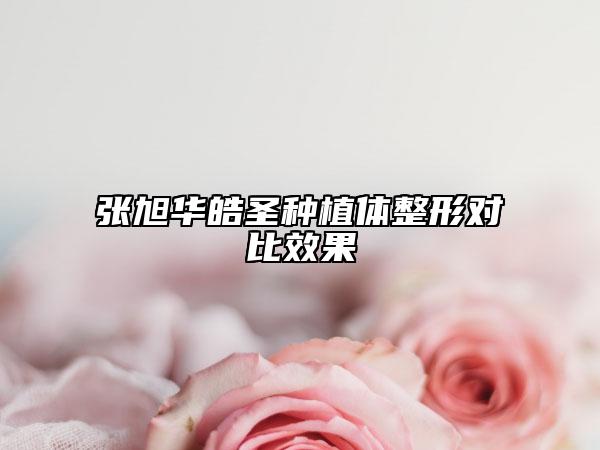 张旭华皓圣种植体整形对比效果