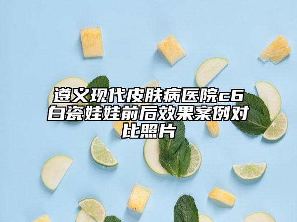 遵义现代皮肤病医院c6白瓷娃娃前后效果案例对比照片