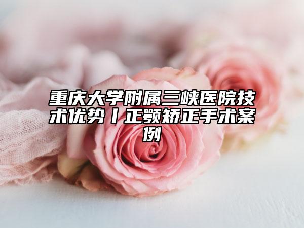 重庆大学附属三峡医院技术优势丨正颚矫正手术案例