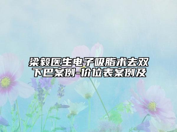 梁毅医生电子吸脂术去双下巴案例-价位表案例及