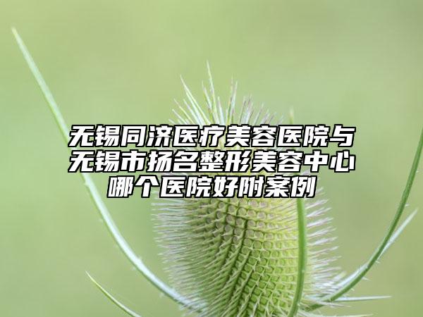 无锡同济医疗美容医院与无锡市扬名整形美容中心哪个医院好附案例
