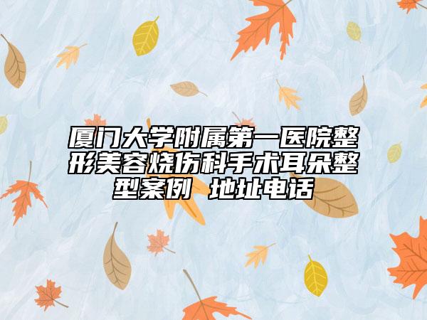 厦门大学附属第一医院整形美容烧伤科手术耳朵整型案例 地址电话