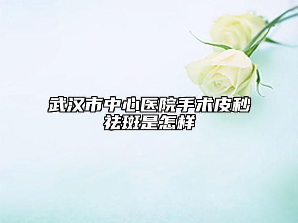 武汉市中心医院手术皮秒祛斑是怎样