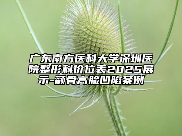 广东南方医科大学深圳医院整形科价位表2025展示-颧骨高脸凹陷案例