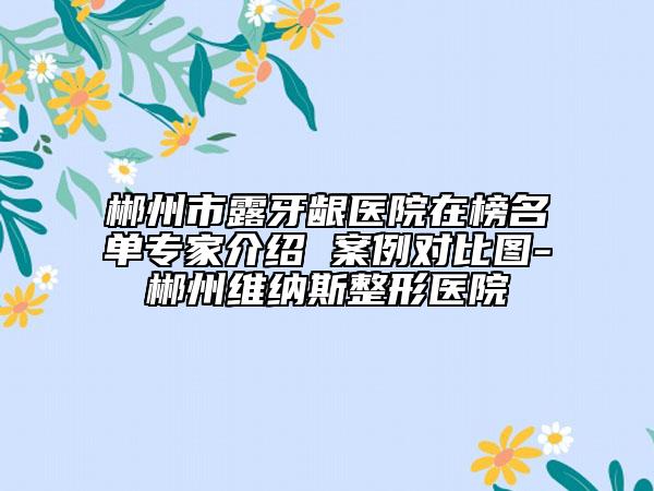 郴州市露牙龈医院在榜名单专家介绍 案例对比图-郴州维纳斯整形医院